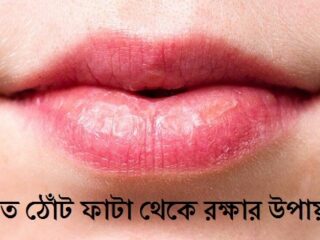 Lips care in winter