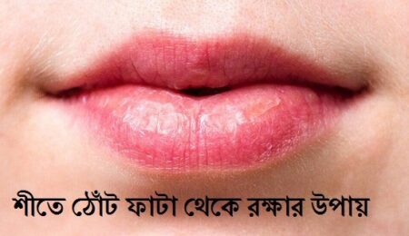 ঠোঁট ফাটা থেকে রক্ষার উপায়