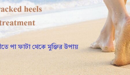 পা ফাটা দূর করার উপায়
